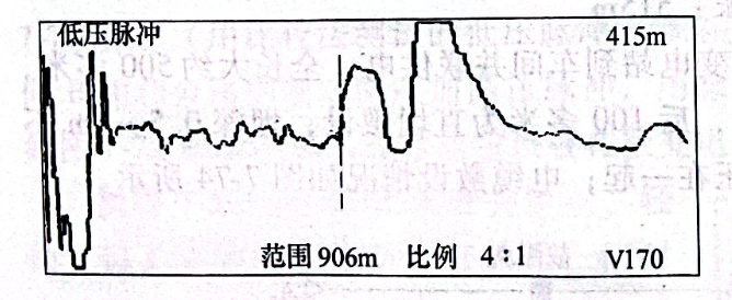 圖22-5電纜2接頭波形 